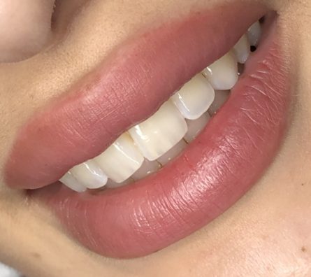 Micropigmentación labios​