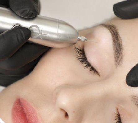 Rejuvenecimiento de Ojos PHIION en Madrid Tres Cantos