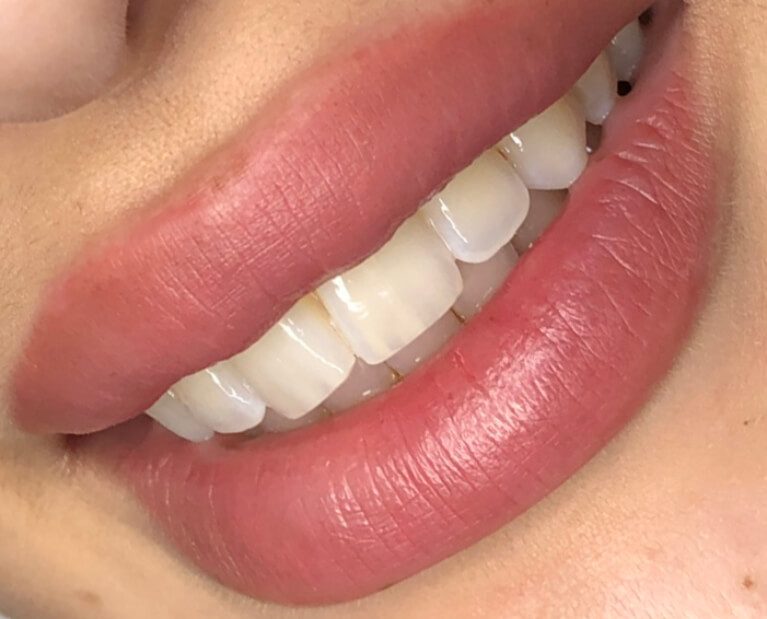 Micropigmentación de Labios